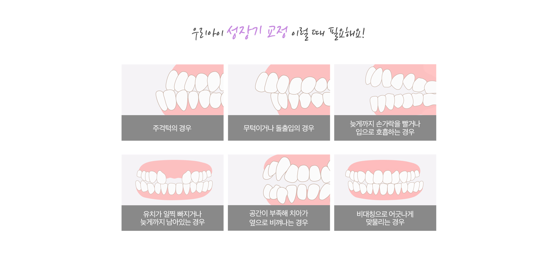 성장기 교정 이럴 때 필요해요