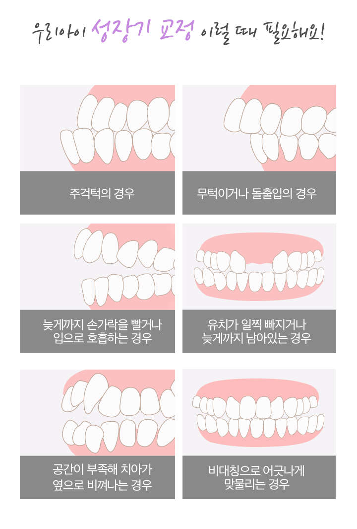 우리아이 성장기 교정 이럴 때 필요해요