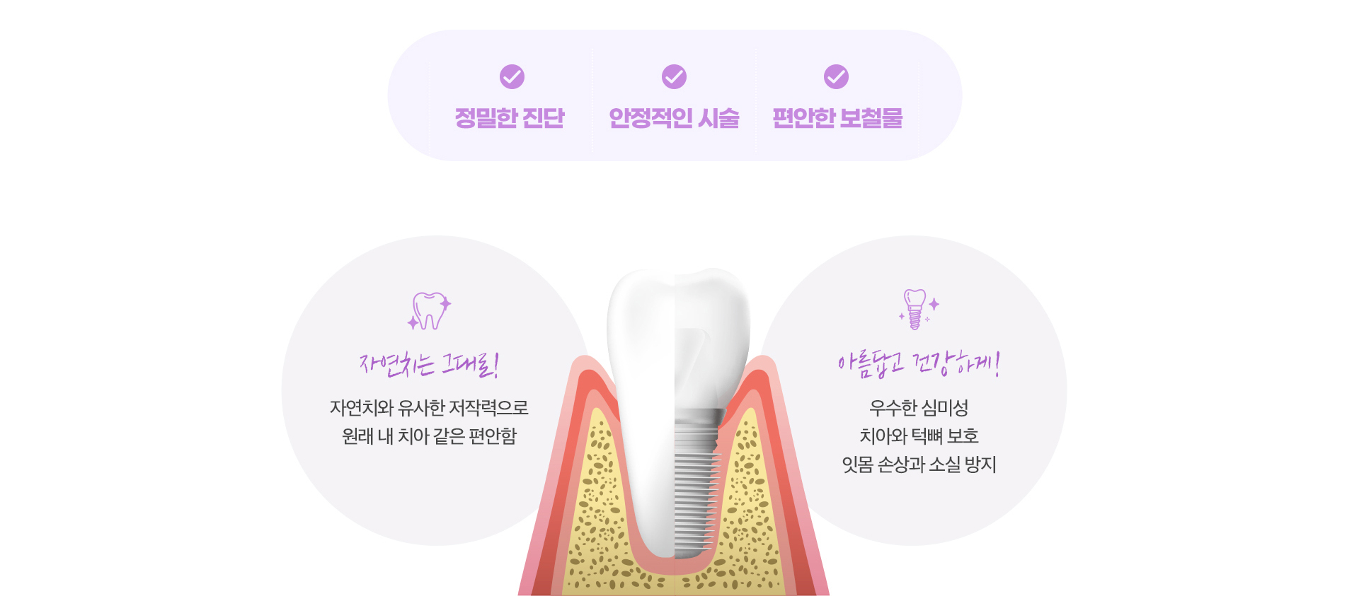 정밀한 진단/안정적인 시술/편안한 보철물