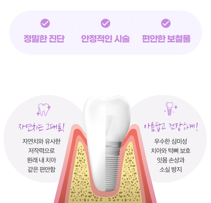 정밀한진단/안정적인시술/편안한보철물